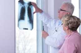 肺部受損，鼻子會出現3個異常，快來看看你的肺部是否健康