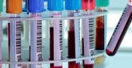 一管血篩查幾十種癌症，到底怎麼做到的？