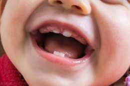 寶寶出牙期的口腔護理 注意飲食和不良反應有哪些