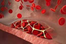 低密度脂蛋白膽固醇低於多少，可最大限度降低心血管疾病的風險？
