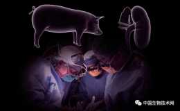 世界首例！豬腎已被移植到人體內，暫時未發生排異反應