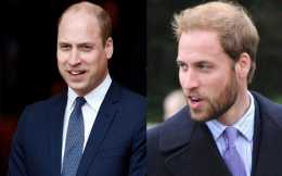哈里緊隨威廉腳步，髮際線令人捉急，英國王室上演“地中海”大比拼