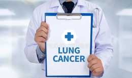 難治的小細胞肺癌，這種組合或許可以帶來更好療效