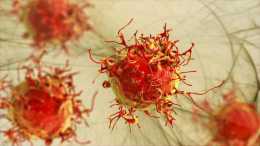 白細胞減少、腹水、癌痛，腫瘤患者出現併發症，應該如何改善？