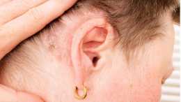 耳朵裡面經常癢，卻啥也掏不出來？或是3種病的表現，別光顧著掏