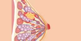 乳腺癌成全球第一大癌症，早發現早治療，它其實不可怕