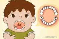 【口腔科普】孩子乳牙齲齒真的不用管嗎？