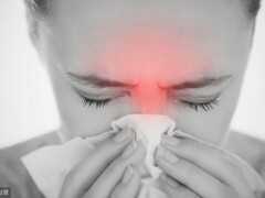 鼻竇炎引起的頭痛怎麼處理？醫生：這7種方法可嘗試