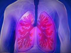 【醫伴旅】11月17日國際肺癌日，關於肺癌你瞭解多少？