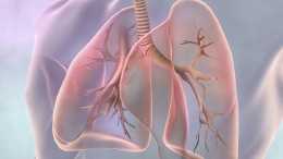 發現肺部有結節怎麼辦？肺部結節就一定是肺癌嗎？