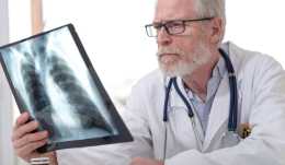 肺癌晚期，有活過10年的嗎？我先舉三個例子為敬，你們評論區補充