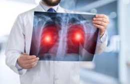 肺癌早期“默默無聞”？若你身上發出3種訊號，其實就是在提醒你