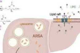 研究揭示芳香基硫酸酯酶A（ARSA）為2型糖尿病的潛在新治療靶點