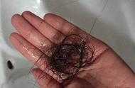 32歲美女產後用這類洗髮水，頭髮一把一把掉，變成地中海髮型