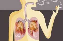 肺癌到底有沒有骨轉移？轉移瞭如何治療？