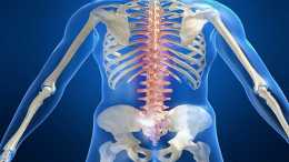 王殿華專家看脊髓空洞症：脊髓空洞症對人體的危害都有哪些？應該怎麼辦？