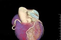 心臟成像技術：心臟成像的人工智慧技術可以改善對病人的護理