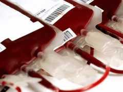 MDS可以多次輸血嗎？