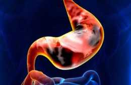 胃癌早期身體有4種症狀，及時防治，胃會慢慢變好，生存率可提高