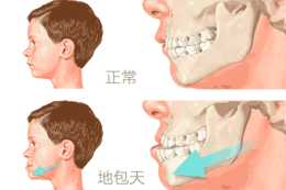 口腔教授分享：7歲左右是第一個牙齒矯正黃金期