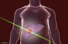 肝癌一發現就是中晚期，4個肝癌早期症狀很多人都以為是小病！