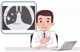 體檢發現肺結節，如何區別良性還是惡性？——上海市一林之楓